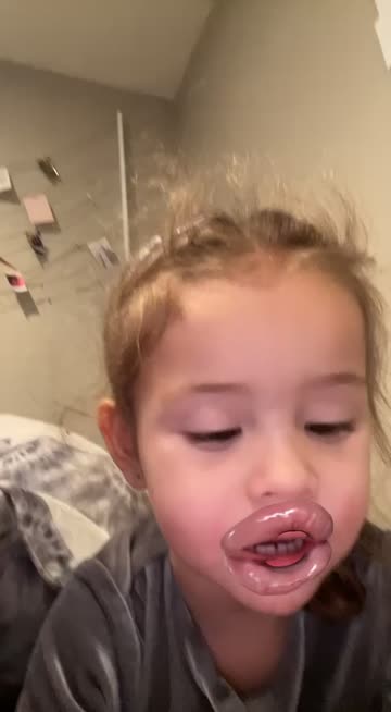 Preview for a Spotlight video that uses the big lips Lens