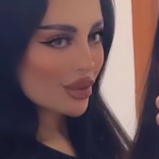 Noni💕