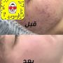 entisar beauty skin