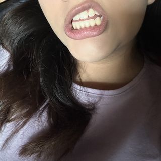 Zoe