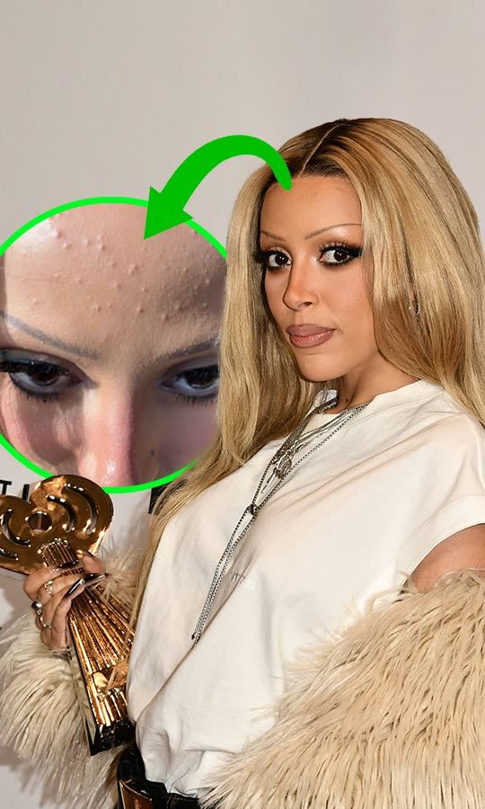 Doja Révèle Son Véritable Visage 🤯