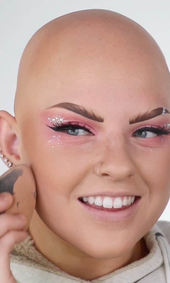 I Have Alopecia And I Love It ❤️