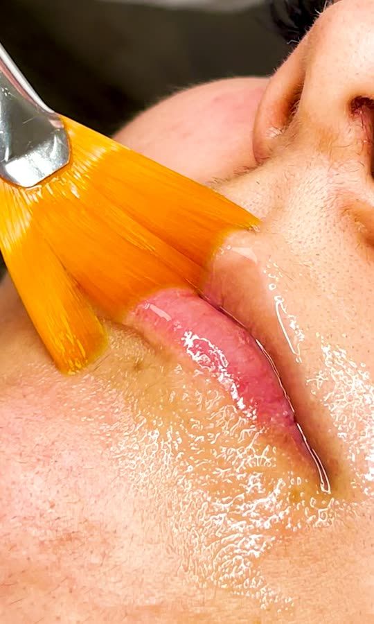 Needle-Less Methods To Plump Lips