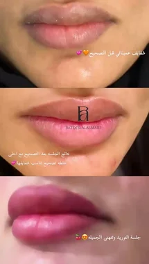 Witness a stunning lip transformation in this three-panel comparison. The video showcases a dramatic change in lip shape, size, and color, highlighting the power of makeup artistry. From natural lips to a fuller, more defined look with a vibrant pink hue, this visual journey demonstrates professional techniques for enhancing one's features. by @batoolmakeup1 with ..
