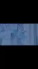 Witness a remarkable dental transformation at Al-Sad Arab Medical Complex. This video showcases a patient's journey from discolored, damaged teeth to a bright, confident smile through advanced implant procedures. See the dramatic 'Before' and 'After' results side-by-side, highlighting the expertise of their dental specialists. by @saudi_medicalce with saudi_medicalce by Original Sound