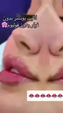 A close-up showcase of a woman's lips before and after a lip filler procedure at Bella Clinic. The video highlights the dramatic enhancement, swelling, and glossy finish, providing a visual guide to the results. by @bellaclinickw with Original Sound by bellaclinickw