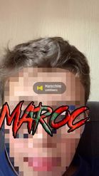 Preview for a Spotlight video that uses the PIXELFACE MAROC Lens