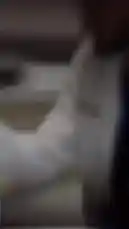 شاهد هذا الفيديو للحصول على استشارة طبية عن بعد مع الدكتور محمد المرغوب، خبير جراحة التجميل. يظهر في الفيديو طبيب يرتدي معطفًا أبيض، ويُعرض رقم واتساب للتواصل المباشر. احصل على استشارتك الطبية الموثوقة بسهولة. by @dralmarghoub with Original Sound by dralmarghoub