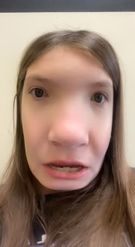 Preview for a Spotlight video that uses the Face Morphing Lens