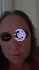 Preview for a Spotlight video that uses the Batman Eyepaint Lens