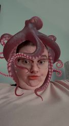 Preview for a Spotlight video that uses the Octopus Lens