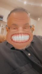Preview for a Spotlight video that uses the Grinning Face Lens