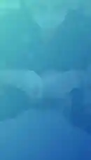 Witness a remarkable dental transformation! This video from مجمع الصدارة المتميز الطبي showcases a patient's journey from crooked, discolored teeth to a bright, confident smile with implants. See the 'Before' and 'After' results, learn about the procedure, and discover why Al Sadar Clinic is a top choice for dental care. by @saudi_medicalce with saudi_medicalce by Original Sound