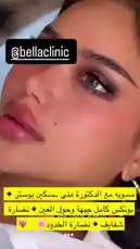 A close-up shot of a woman's face showcases her flawless makeup and skin. Text overlays reveal the name '@bellclinic' and the phrase 'I'VE BEEN TALKING', suggesting she is discussing her experience at the clinic. This appears to be a promotional post highlighting the results of treatments offered by Bella Clinic. by @bellaclinickw with baby baby🤌 by K2M🔥🔥