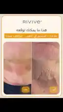 Watch Rivive's powerful results unfold in real-time. This split-screen comparison shows dramatic improvements in skin texture, tone, and firmness within just one week. Discover why users love Rivive's advanced formula for visibly smoother, younger-looking skin. by @rivive.sa with original sound