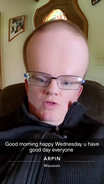Preview for a Spotlight video that uses the BIG Forehead Lens