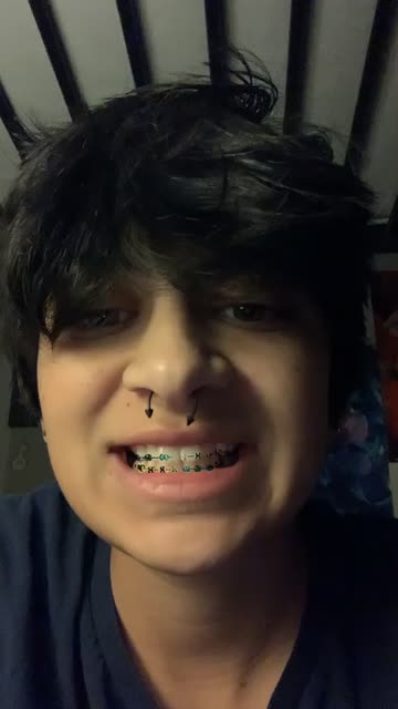 Preview for a Spotlight video that uses the braces Lens