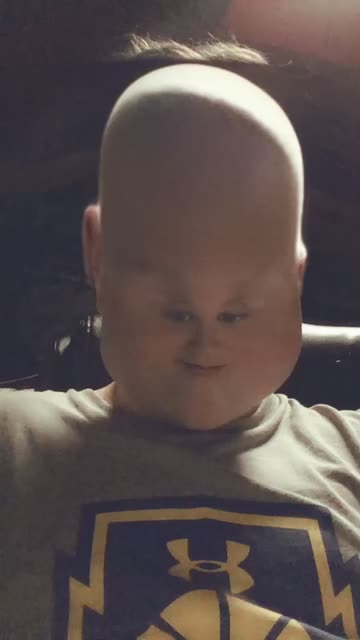 Preview for a Spotlight video that uses the Bald Small Face Lens