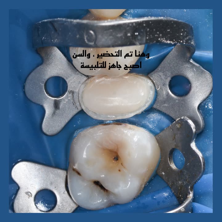 محتوى سناب شات لـ Dr Munther ✨🦷