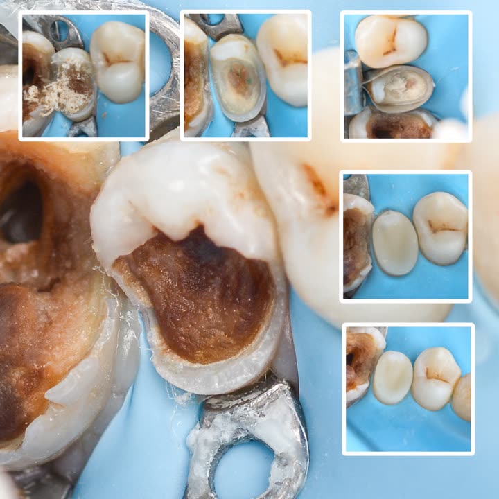 محتوى سناب شات لـ Dr Munther ✨🦷