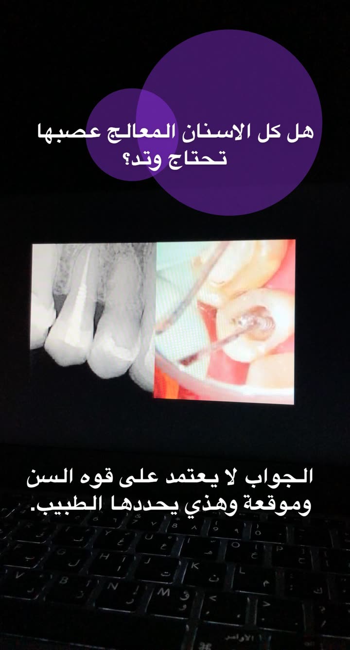 محتوى سناب شات لـ د. ساره الفدا