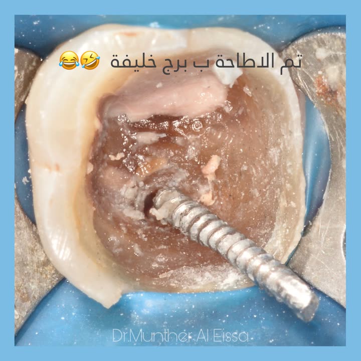 محتوى سناب شات لـ Dr Munther ✨🦷