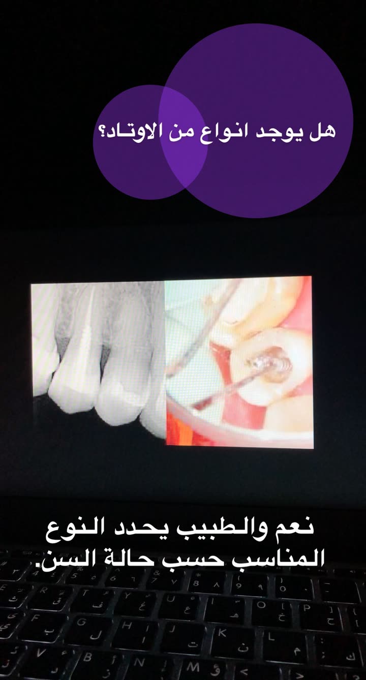 محتوى سناب شات لـ د. ساره الفدا