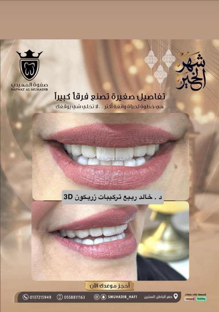 محتوى سناب شات لـ عاجل الحفر