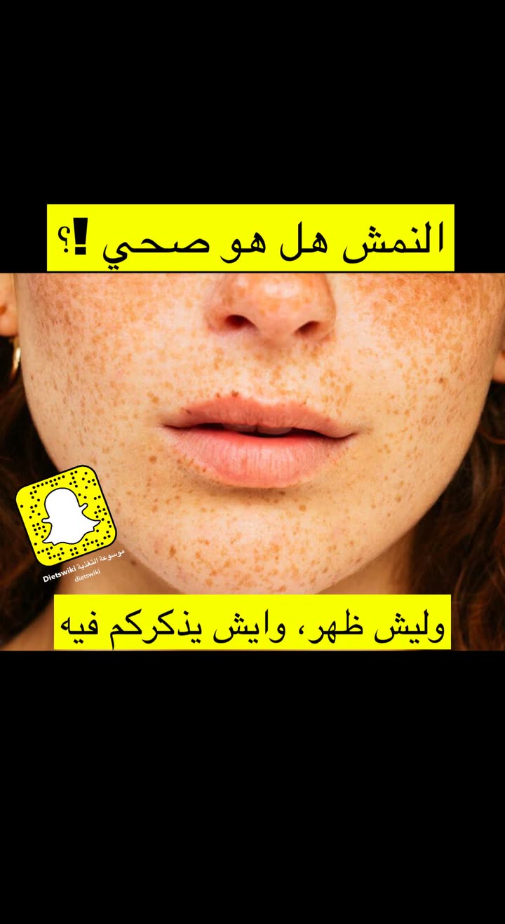 محتوى سناب شات لـ عمار العمار “DietsWiki"