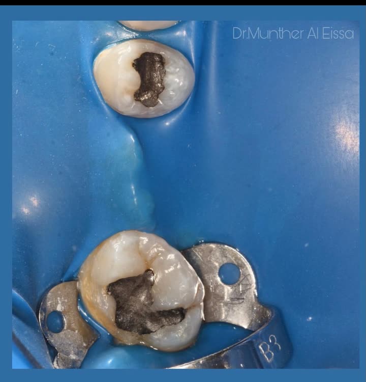 محتوى سناب شات لـ Dr Munther ✨🦷