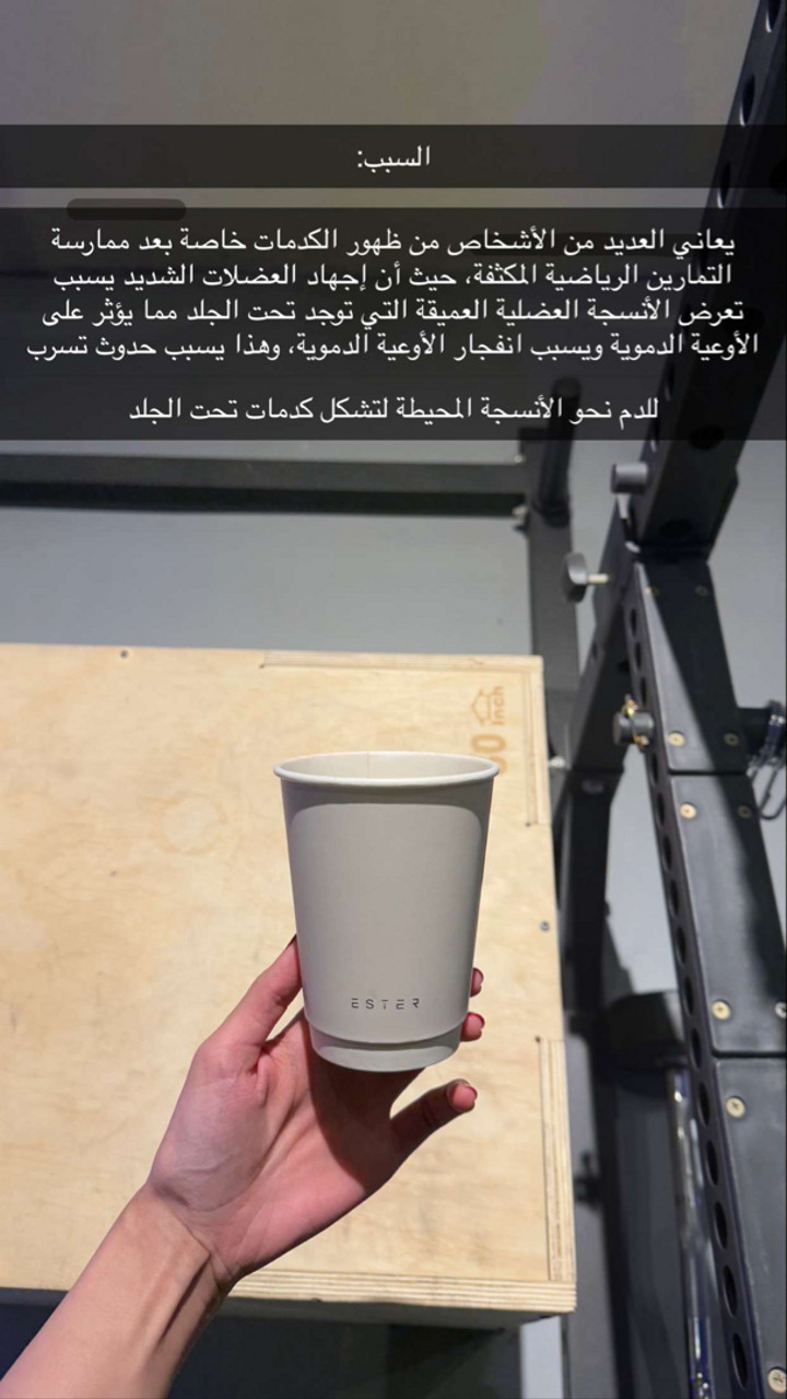 محتوى سناب شات لـ COACH GHAND ♡ ‏