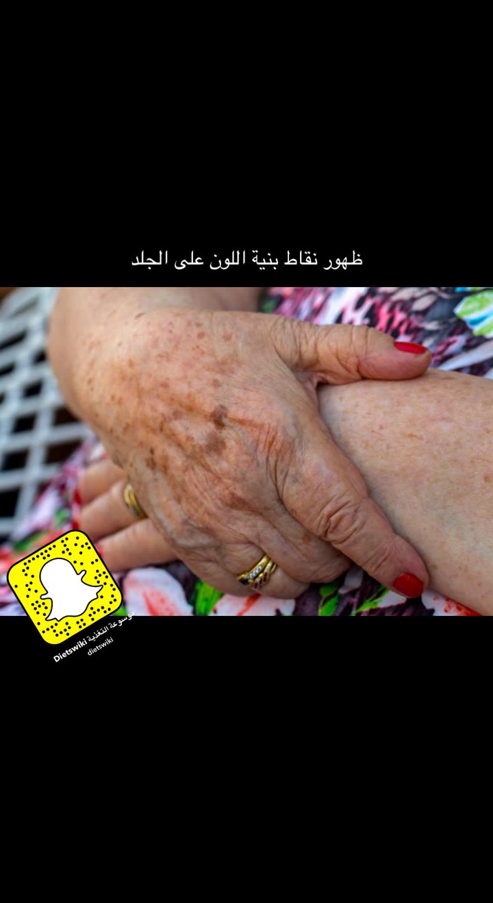 محتوى سناب شات لـ عمار العمار “DietsWiki"