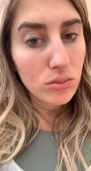 Preview for a Spotlight video that uses the Lip Injection Lens