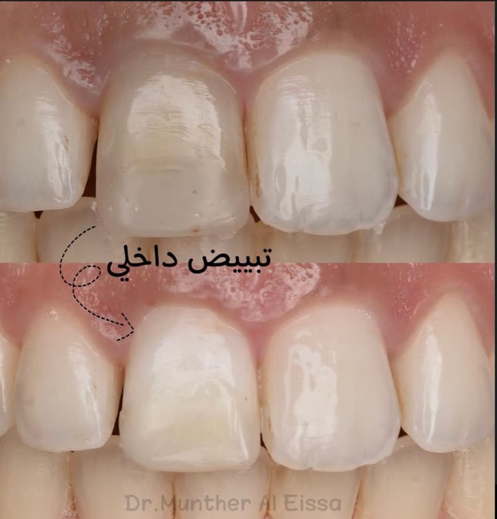 محتوى سناب شات لـ Dr Munther ✨🦷