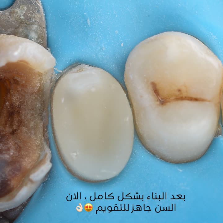 محتوى سناب شات لـ Dr Munther ✨🦷