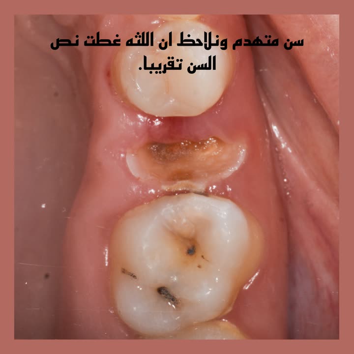محتوى سناب شات لـ Dr Munther ✨🦷