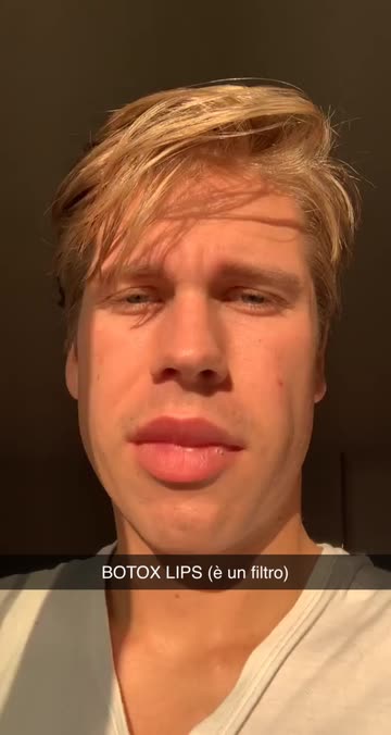 Preview for a Spotlight video that uses the Botox lips Lens