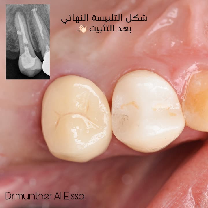 محتوى سناب شات لـ Dr Munther ✨🦷
