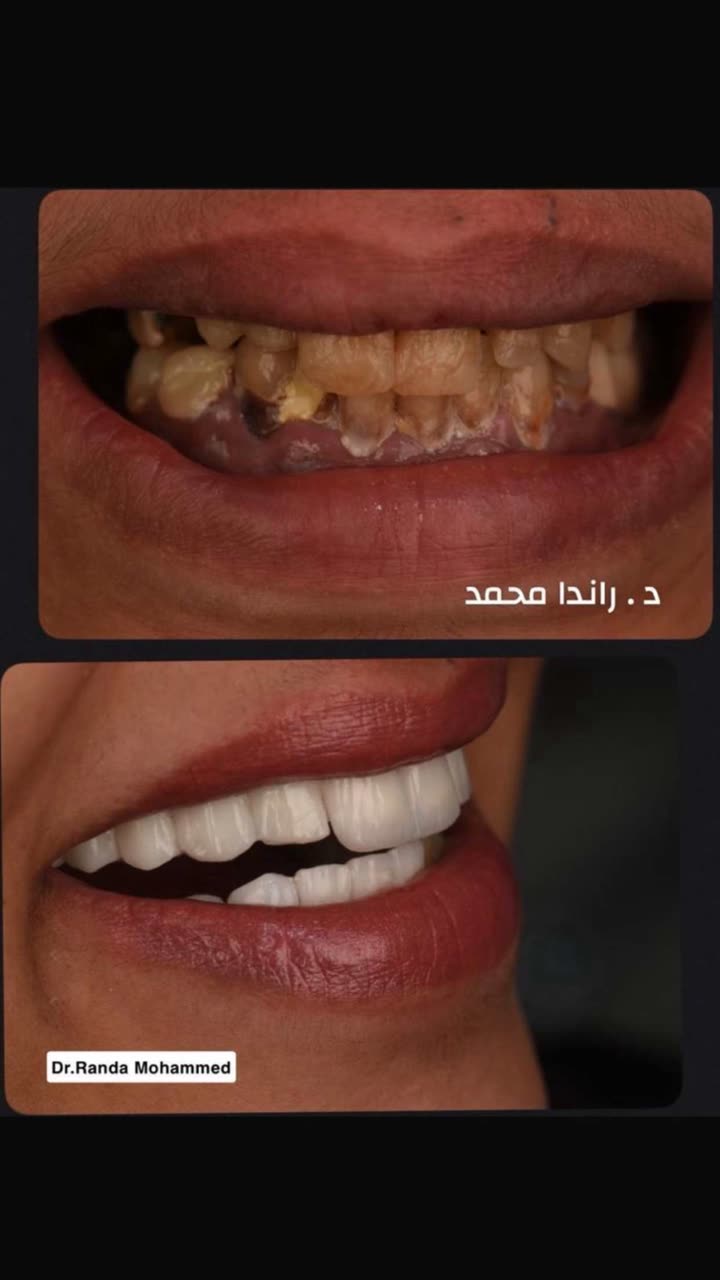 محتوى سناب شات لـ عاجل الحفر