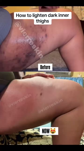 www.vierreskin.com