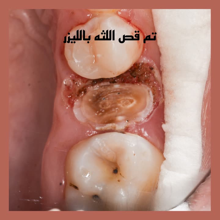 محتوى سناب شات لـ Dr Munther ✨🦷