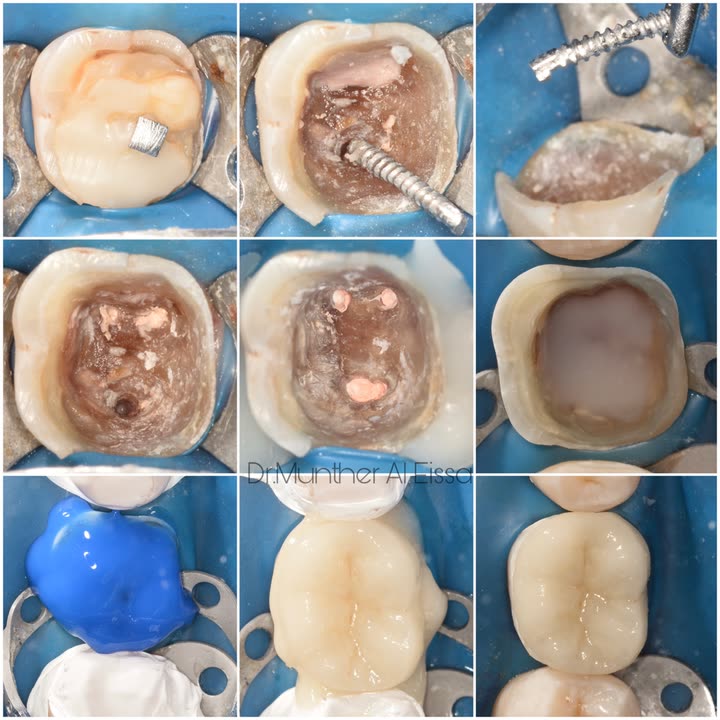 محتوى سناب شات لـ Dr Munther ✨🦷
