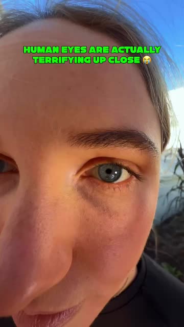 Eyepic