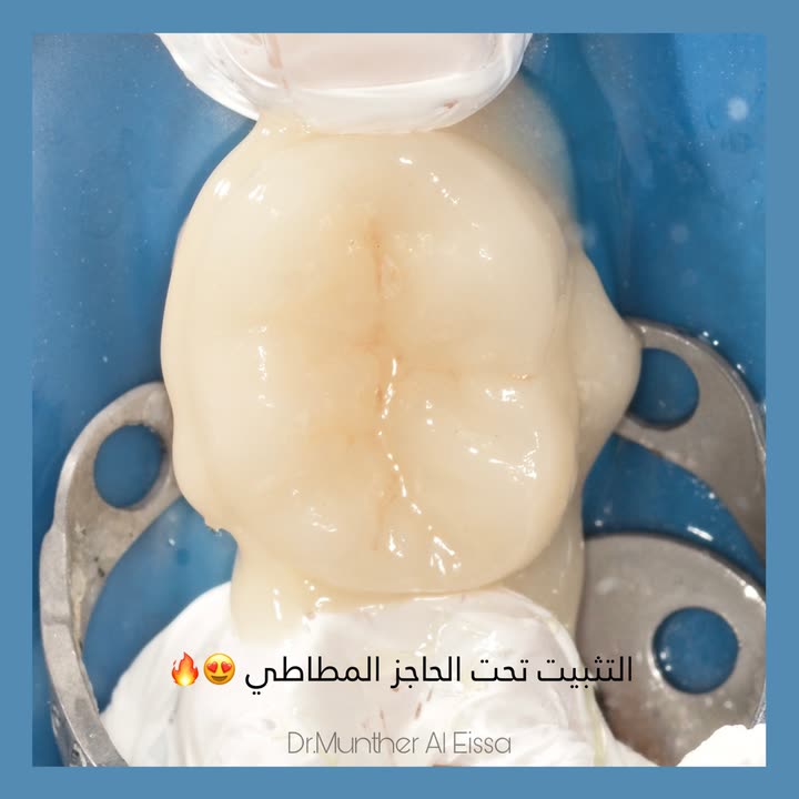 محتوى سناب شات لـ Dr Munther ✨🦷