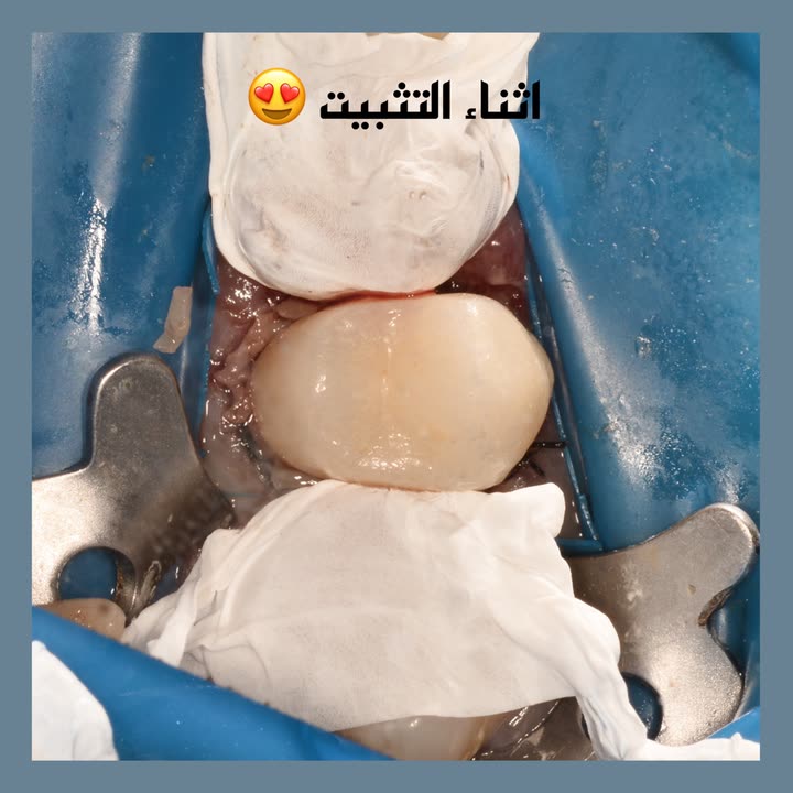 محتوى سناب شات لـ Dr Munther ✨🦷