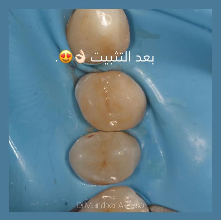 محتوى سناب شات لـ Dr Munther ✨🦷