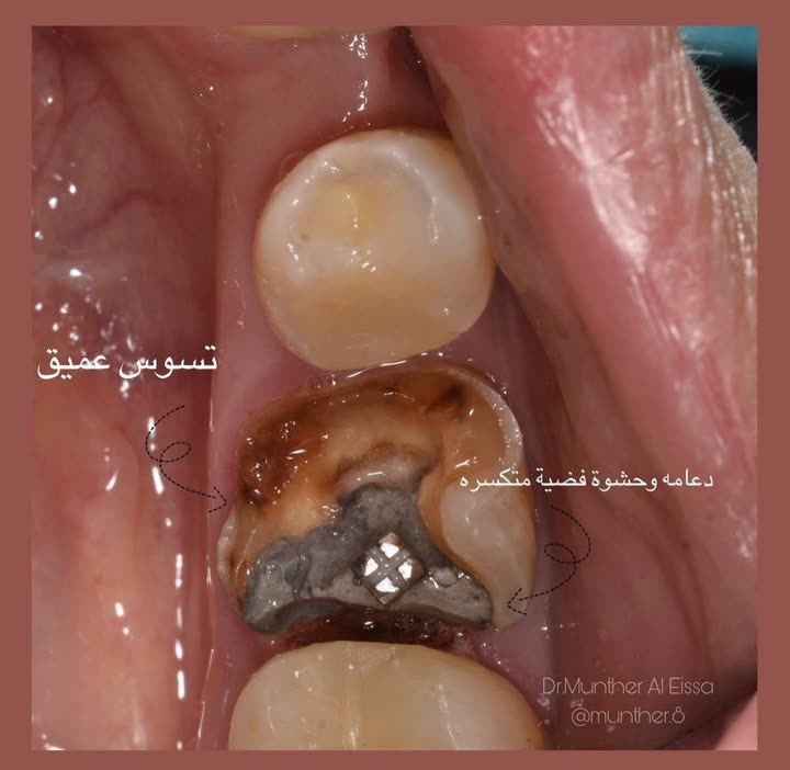 محتوى سناب شات لـ Dr Munther ✨🦷