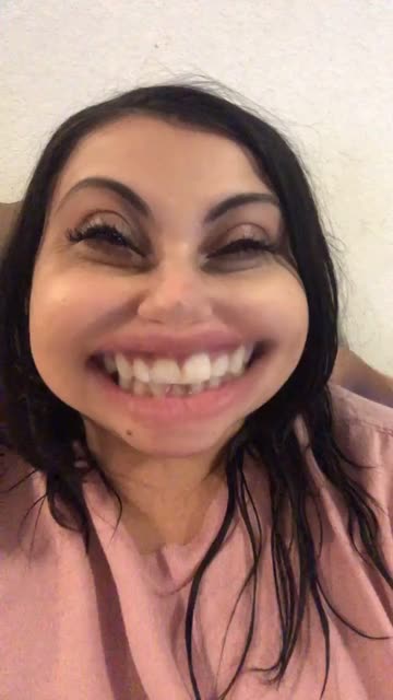 Preview for a Spotlight video that uses the Botox face Lens