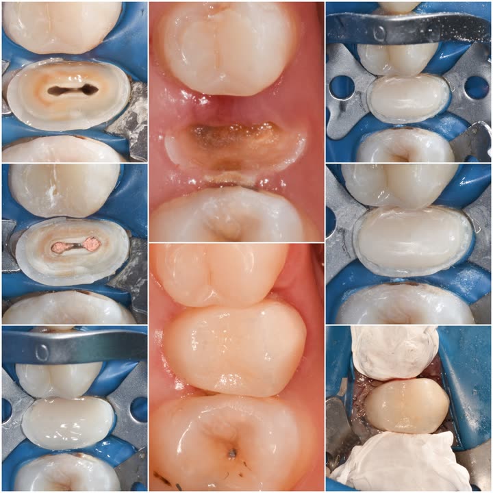 محتوى سناب شات لـ Dr Munther ✨🦷