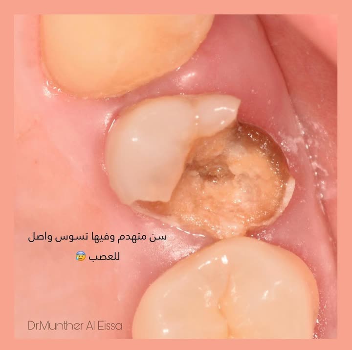 محتوى سناب شات لـ Dr Munther ✨🦷